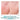 FACTORFIVE 7-Day Post-Treatment Kit before and after image — client recovery result, view 4